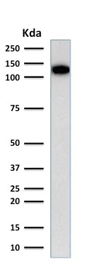 Anti-CD31 antibody [C31.3] (ab187377) | Abcam