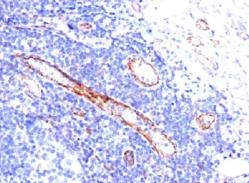Immunohistochemistry (Formalin/PFA-fixed paraffin-embedded sections) - Anti-CD31 antibody [C31.3] - BSA and Azide free (AB212709)