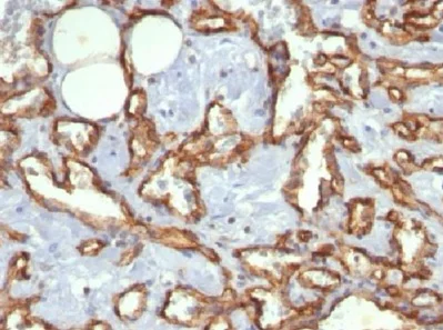 Immunohistochemistry (Formalin/PFA-fixed paraffin-embedded sections) - Anti-CD31 antibody [C31.3] - BSA and Azide free (AB212709)