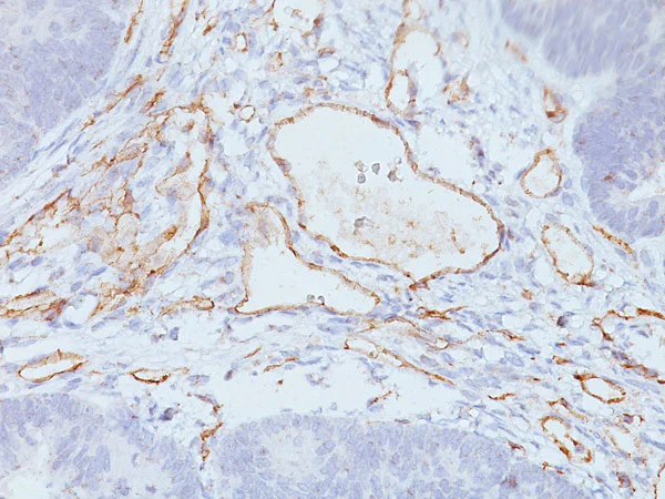 Immunohistochemistry (Formalin/PFA-fixed paraffin-embedded sections) - Anti-CD31 antibody [C31.3 + JC/70A] (AB199012)