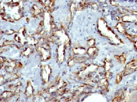 Immunohistochemistry (Formalin/PFA-fixed paraffin-embedded sections) - Anti-CD31 antibody [C31.3 + JC/70A] - BSA and Azide free (AB212711)