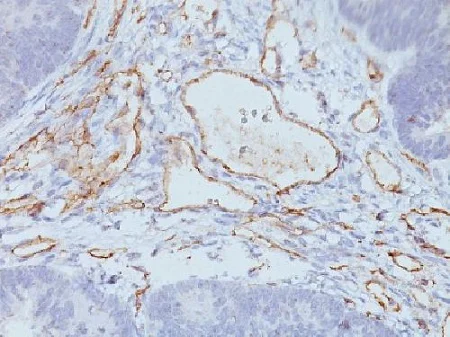Immunohistochemistry (Formalin/PFA-fixed paraffin-embedded sections) - Anti-CD31 antibody [C31.3 + JC/70A] - BSA and Azide free (AB212711)