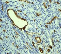 Immunohistochemistry (Formalin/PFA-fixed paraffin-embedded sections) - Anti-CD31 antibody [EP3095] - BSA and Azide free (AB226157)