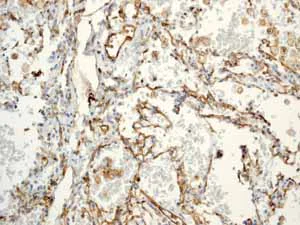 Immunohistochemistry (Formalin/PFA-fixed paraffin-embedded sections) - Anti-CD31 antibody [EP3095] - BSA and Azide free (AB226157)