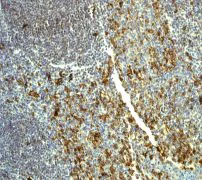 Immunohistochemistry (Formalin/PFA-fixed paraffin-embedded sections) - Anti-CD31 antibody [EP3095] - Low endotoxin, Azide free (AB216459)