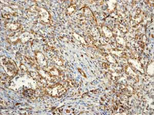 Immunohistochemistry (Formalin/PFA-fixed paraffin-embedded sections) - Anti-CD31 antibody [EP3095] - Low endotoxin, Azide free (AB216459)
