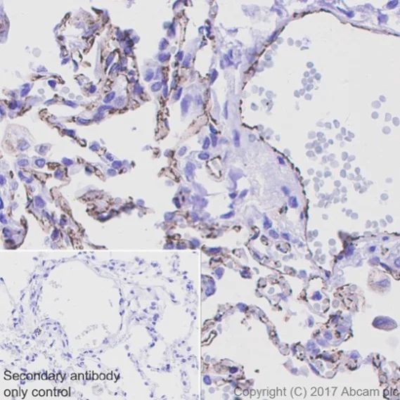 Immunohistochemistry (Formalin/PFA-fixed paraffin-embedded sections) - Anti-CD31 antibody [EPR17259] (AB182981)