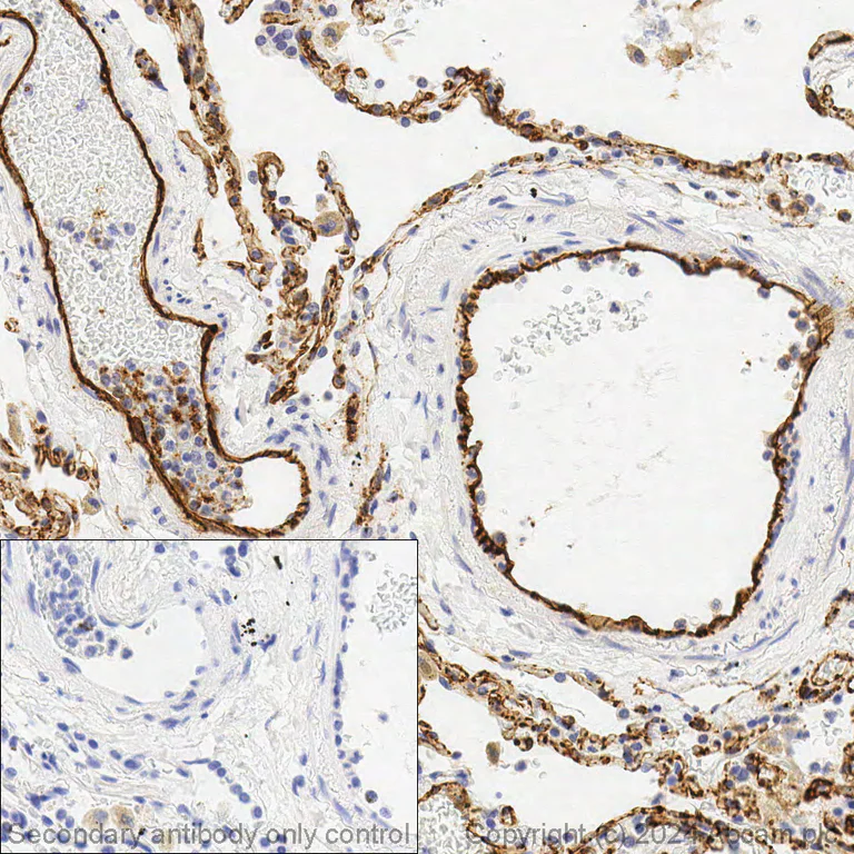 Immunohistochemistry (Formalin/PFA-fixed paraffin-embedded sections) - Anti-CD31 antibody [EPR17259] (AB182981)
