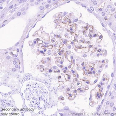 Immunohistochemistry (Formalin/PFA-fixed paraffin-embedded sections) - Anti-CD31 antibody [EPR17259] (AB182981)