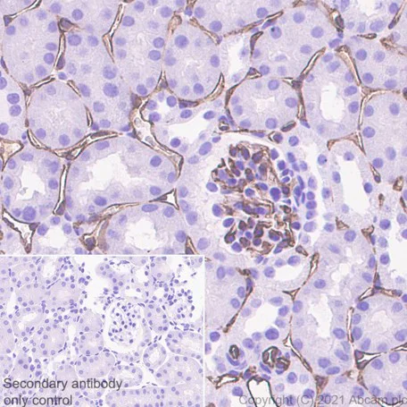 Immunohistochemistry (Formalin/PFA-fixed paraffin-embedded sections) - Anti-CD31 antibody [EPR17259] (AB182981)