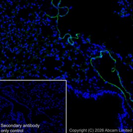 Anti-CD31 抗体 [EPR17259] (ab182981) | Abcam
