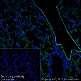 Anti-CD31 antibody [EPR17259] 20 ul size (ab182981) | Abcam