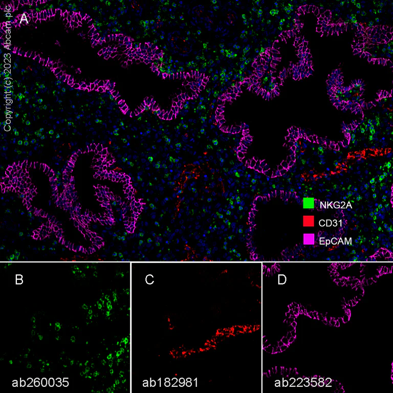 Multiplex immunohistochemistry - Anti-CD31 antibody [EPR17259] (AB182981)