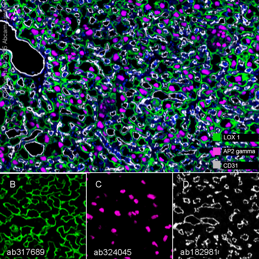 Anti-CD31 antibody [EPR17259]