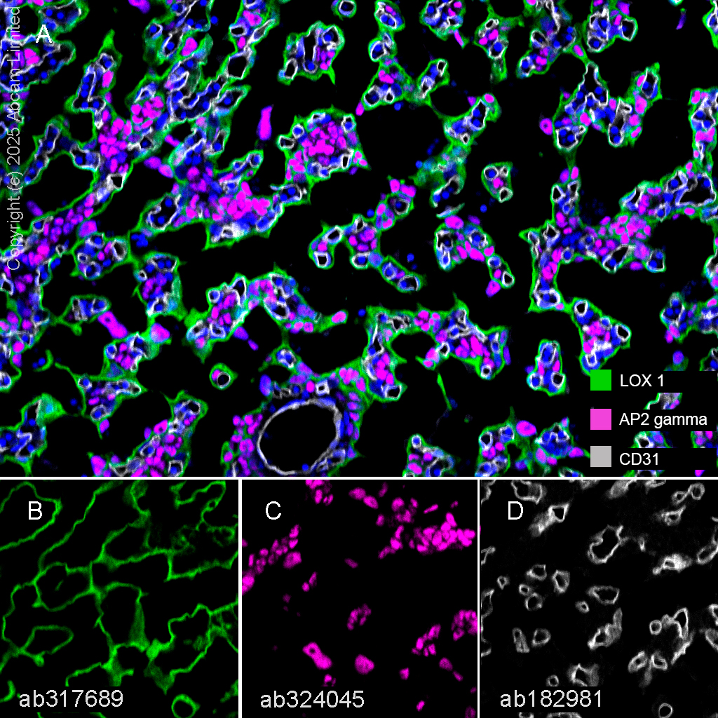 Anti-CD31 antibody [EPR17259] - BSA and Azide free