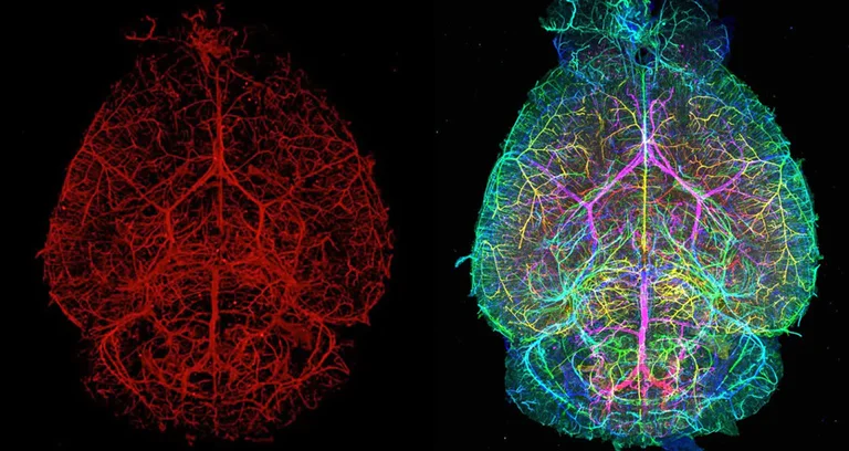 IHC-tissue clearing - Anti-CD31 antibody [EPR17260-254] - BSA and Azide free (AB271994)