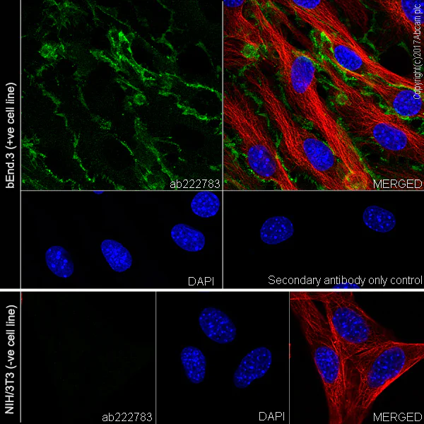 Immunocytochemistry/ Immunofluorescence - Anti-CD31 antibody [EPR17260-263] (AB222783)