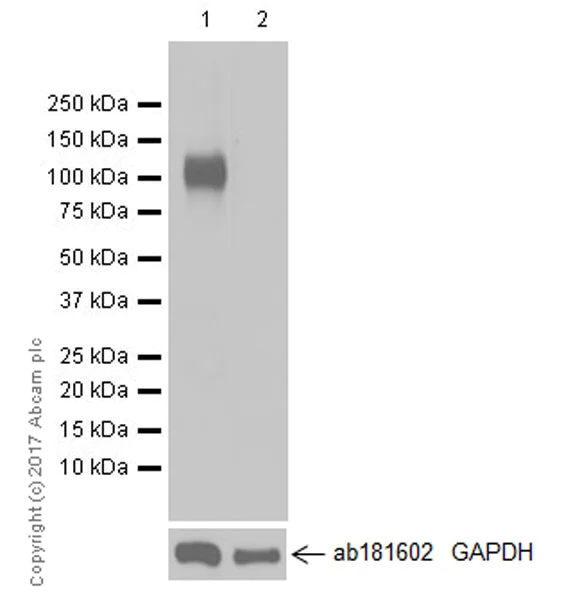 Western blot - Anti-CD31 antibody [EPR17260-263] (AB222783)