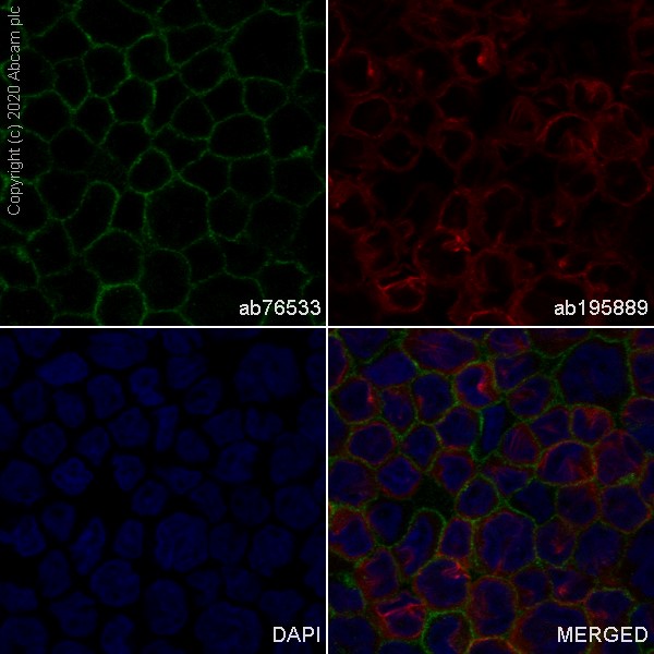 Immunocytochemistry/ Immunofluorescence - Anti-CD31 antibody [EPR3094] (AB76533), expandable thumbnail
