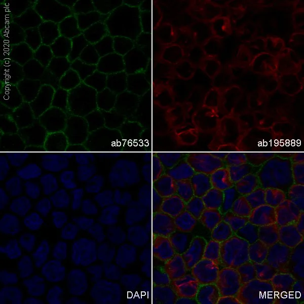 Immunocytochemistry/ Immunofluorescence - Anti-CD31 antibody [EPR3094] (AB76533)