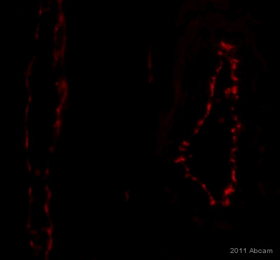 Immunohistochemistry (Formalin/PFA-fixed paraffin-embedded sections) - Anti-CD31 antibody [EPR3094] (ab76533), expandable thumbnail