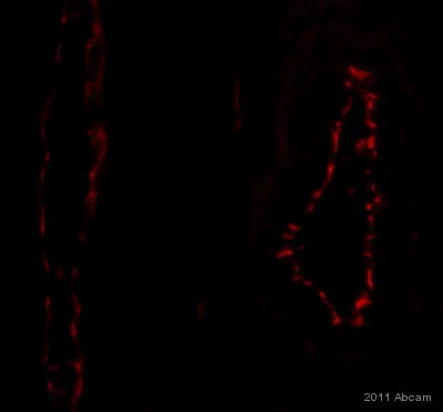Immunohistochemistry (Formalin/PFA-fixed paraffin-embedded sections) - Anti-CD31 antibody [EPR3094] (AB76533)
