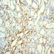 Immunohistochemistry (Formalin/PFA-fixed paraffin-embedded sections) - Anti-CD31 antibody [EPR3094] (ab76533), expandable thumbnail