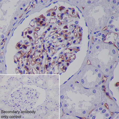 Immunohistochemistry (Formalin/PFA-fixed paraffin-embedded sections) - Anti-CD31 antibody [EPR3094] (AB76533), expandable thumbnail