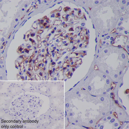 Immunohistochemistry (Formalin/PFA-fixed paraffin-embedded sections) - Anti-CD31 antibody [EPR3094] (AB76533)