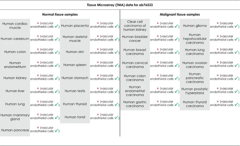 Immunohistochemistry (Formalin/PFA-fixed paraffin-embedded sections) - Anti-CD31 antibody [EPR3094] (AB76533)