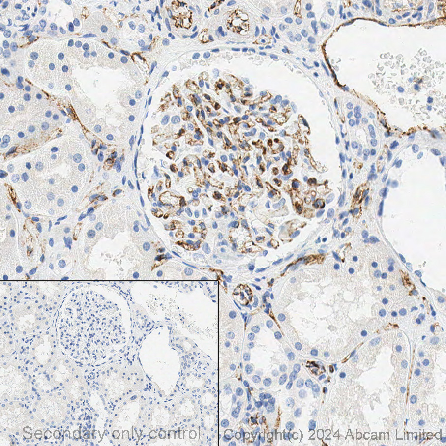 Immunohistochemistry (Formalin/PFA-fixed paraffin-embedded sections) - Anti-CD31 antibody [EPR3094] (ab76533), expandable thumbnail