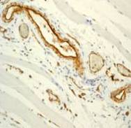 Immunohistochemistry (Formalin/PFA-fixed paraffin-embedded sections) - Anti-CD31 antibody [EPR3094] (ab76533), expandable thumbnail