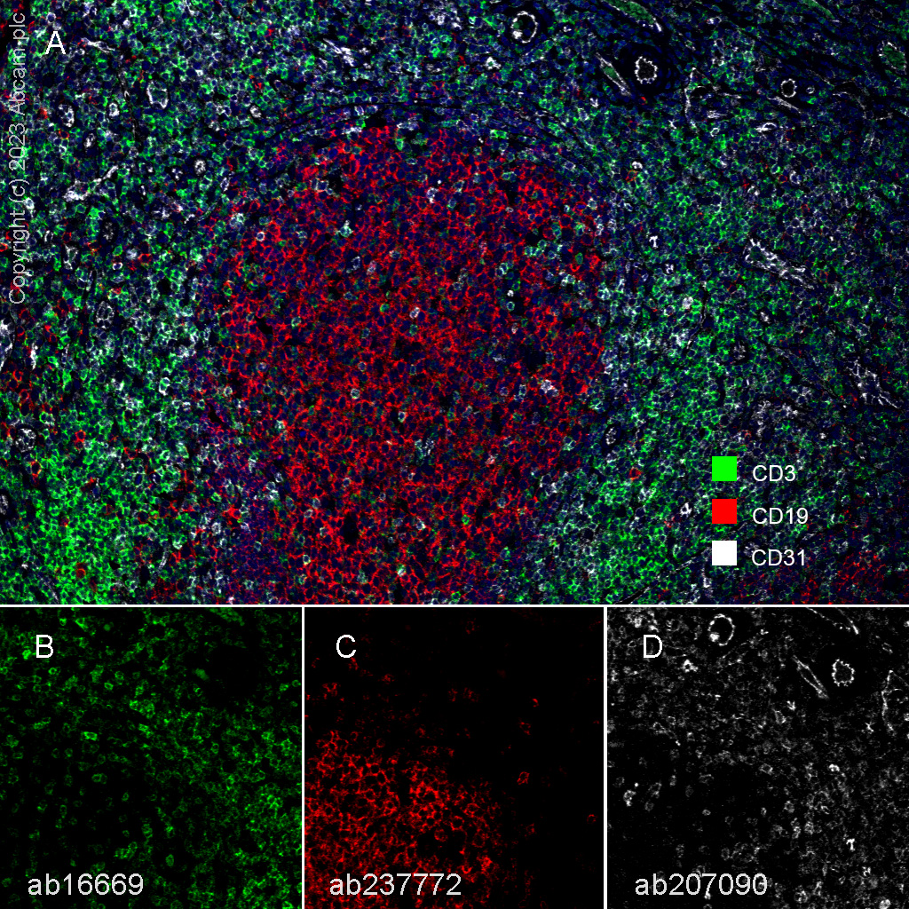 Multiplex immunohistochemistry - Anti-CD31 antibody [EPR3094] (ab76533), expandable thumbnail