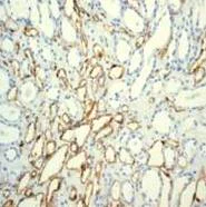 Immunohistochemistry (Formalin/PFA-fixed paraffin-embedded sections) - Anti-CD31 antibody [EPR3094] - BSA and Azide free (AB207090)