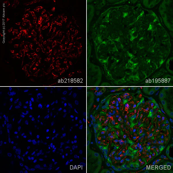 Immunohistochemistry (Formalin/PFA-fixed paraffin-embedded sections) - Anti-CD31 antibody [EPR3094] - BSA and Azide free (AB207090)