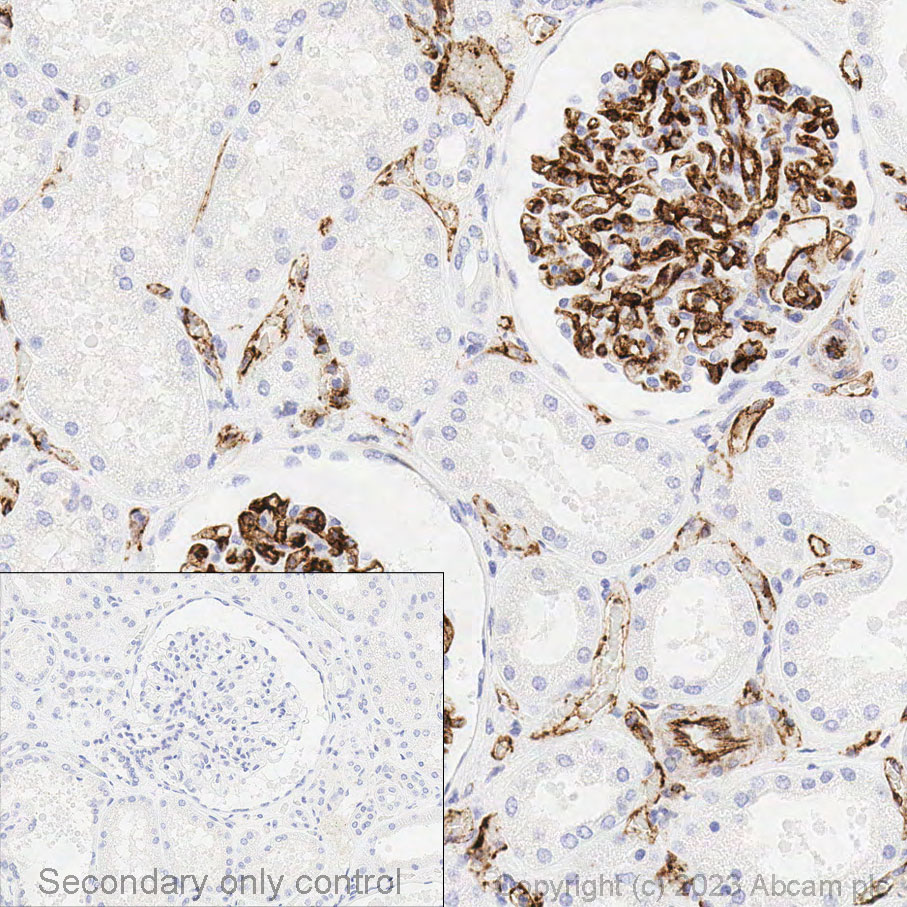 Immunohistochemistry (Formalin/PFA-fixed paraffin-embedded sections) - Anti-CD31 antibody [EPR3094] - BSA and Azide free (ab207090), expandable thumbnail