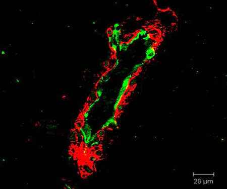 Immunohistochemistry (Formalin/PFA-fixed paraffin-embedded sections) - Anti-CD31 antibody [EPR3094] - BSA and Azide free (AB207090)