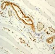 Immunohistochemistry (Formalin/PFA-fixed paraffin-embedded sections) - Anti-CD31 antibody [EPR3094] - BSA and Azide free (AB207090)