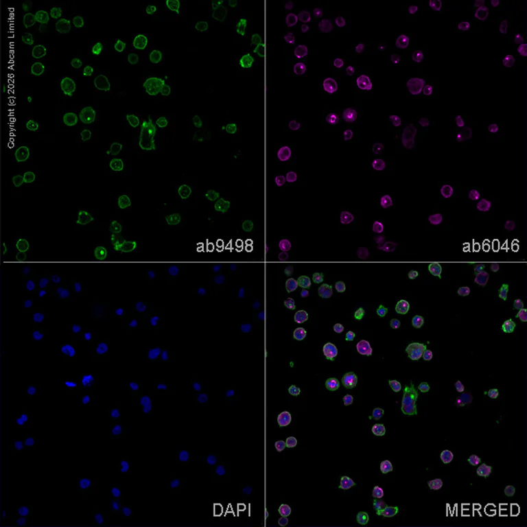 Immunocytochemistry/ Immunofluorescence - Anti-CD31 antibody [JC/70A] (AB9498)