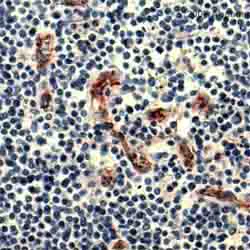 Immunohistochemistry (Formalin/PFA-fixed paraffin-embedded sections) - Anti-CD31 antibody [JC/70A] (AB9498)