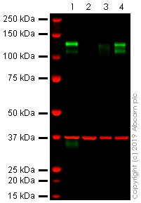 Western blot - Anti-CD31 antibody [JC/70A] (AB9498)
