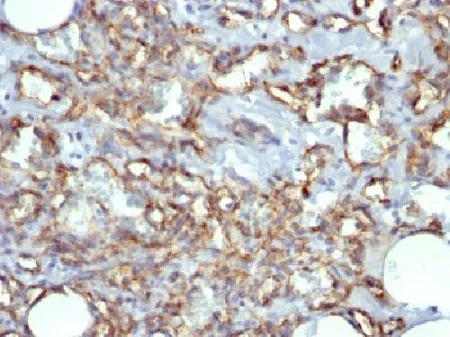 Immunohistochemistry (Formalin/PFA-fixed paraffin-embedded sections) - Anti-CD31 antibody [JC/70A] - BSA and Azide free (AB212712)