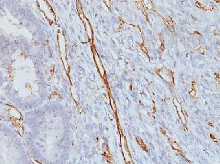 Immunohistochemistry (Formalin/PFA-fixed paraffin-embedded sections) - Anti-CD31 antibody [JC/70A] - BSA and Azide free (AB212712)