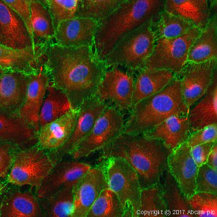 Immunocytochemistry - Anti-CD31 antibody [JC/70A] - BSA and Azide free (AB264090)