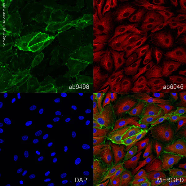 Immunocytochemistry - Anti-CD31 antibody [JC/70A] - BSA and Azide free (AB264090)