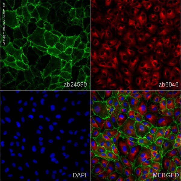 Immunocytochemistry - Anti-CD31 antibody [P2B1] (AB24590), expandable thumbnail