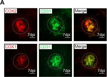 Immunocytochemistry/ Immunofluorescence - Anti-CD31 antibody [P2B1] (AB24590)
