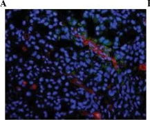 Immunohistochemistry - Anti-CD31 antibody [P2B1] (AB24590)