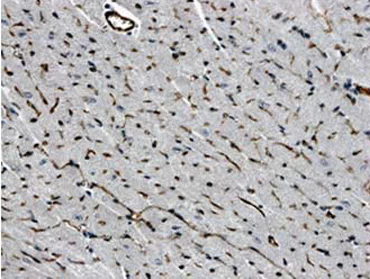 Immunohistochemistry (Formalin/PFA-fixed paraffin-embedded sections) - Anti-CD31 antibody [RM0032-1D12] - BSA and Azide free (AB56299)