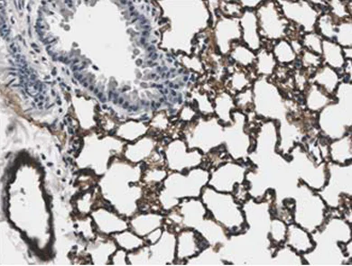 Immunohistochemistry (Formalin/PFA-fixed paraffin-embedded sections) - Anti-CD31 antibody [RM0032-1D12] - BSA and Azide free (AB56299)